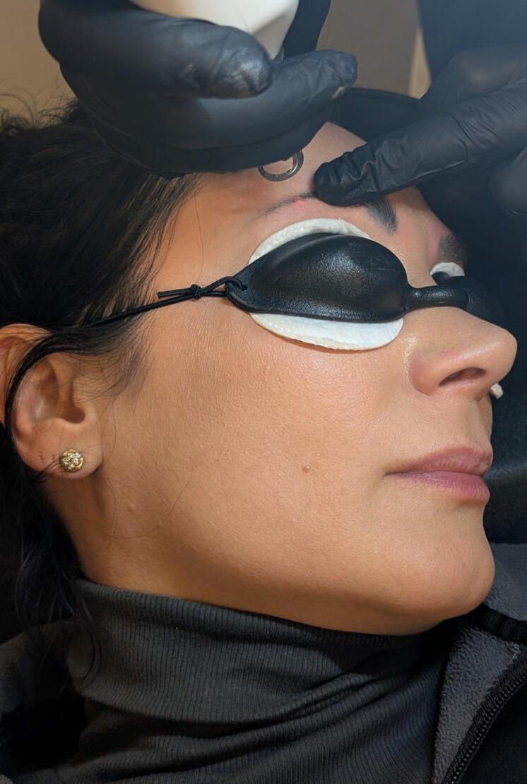 Laser Eyebrows